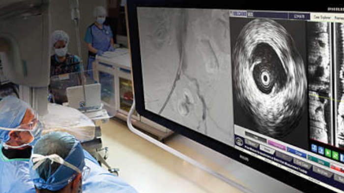 Peripheral imaging catheters