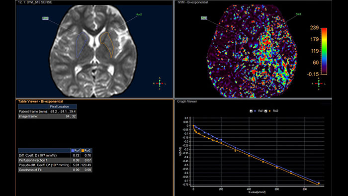 advanced diffusion analysis thumbnail