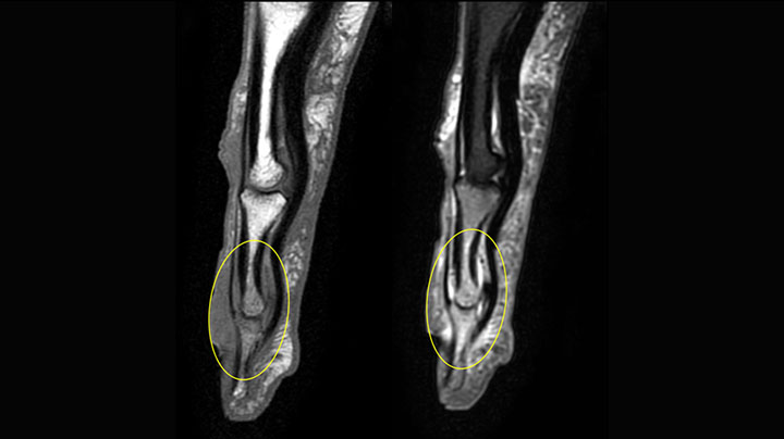 finger MRI