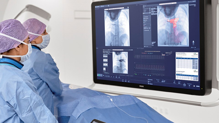 Congenital Heart Disease Interventions 